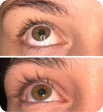 Depoimento da cliente Michele sobre sérum Peacock - Resultados visíveis no crescimento de cílios em poucos dias
