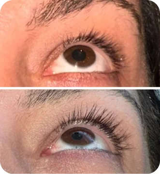 Depoimento da cliente Ana Paula sobre sérum para cílios Peacock - Transformação impressionante dos cílios