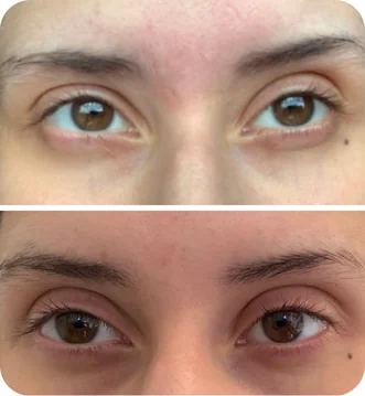 Depoimento da cliente Ana Carolina sobre sérum Peacock - Cílios naturalmente mais fortes e saudáveis