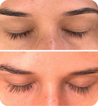 Depoimento da cliente Brenda sobre sérum vegano Peacock - Resultados surpreendentes no crescimento dos cílios