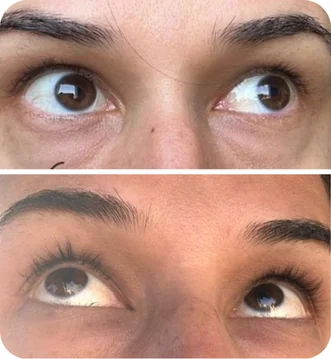 Depoimento da cliente Camila sobre sérum Peacock - Cílios mais densos e definidos com produto vegano