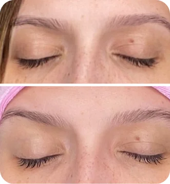 Depoimento da cliente Gabriela sobre sérum para crescimento de cílios Peacock - Transformação completa do olhar